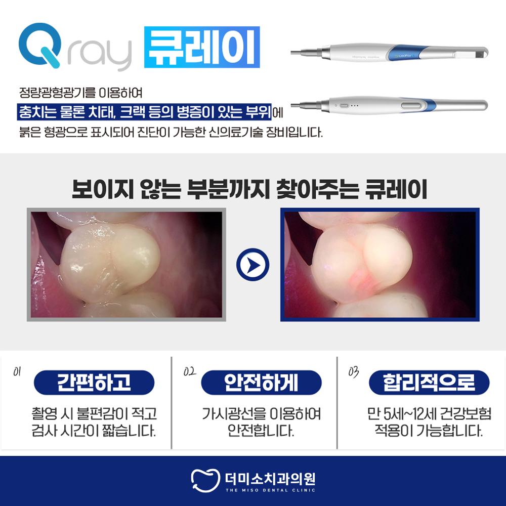 더미소치과 충치치료