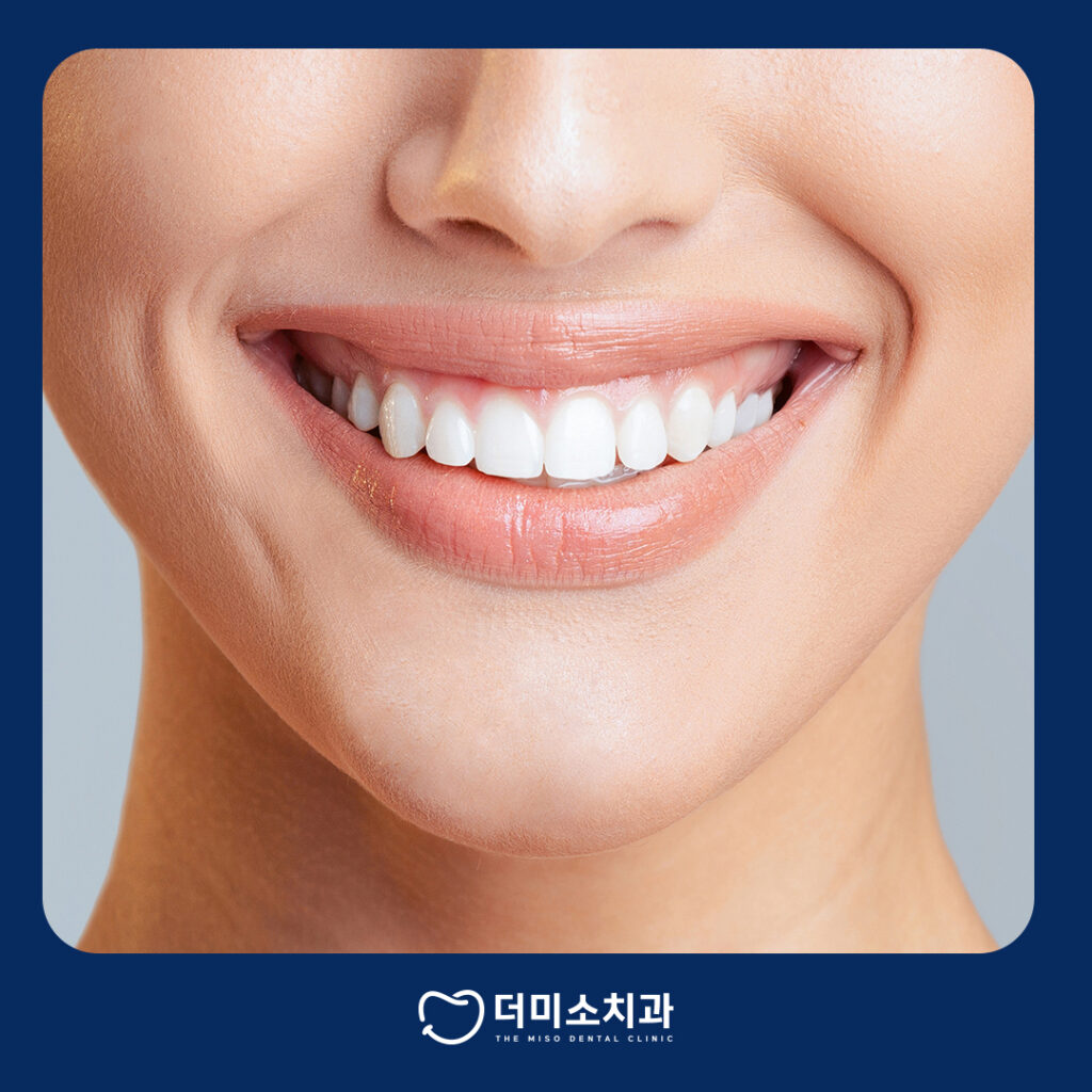 더미소치과 치아미백