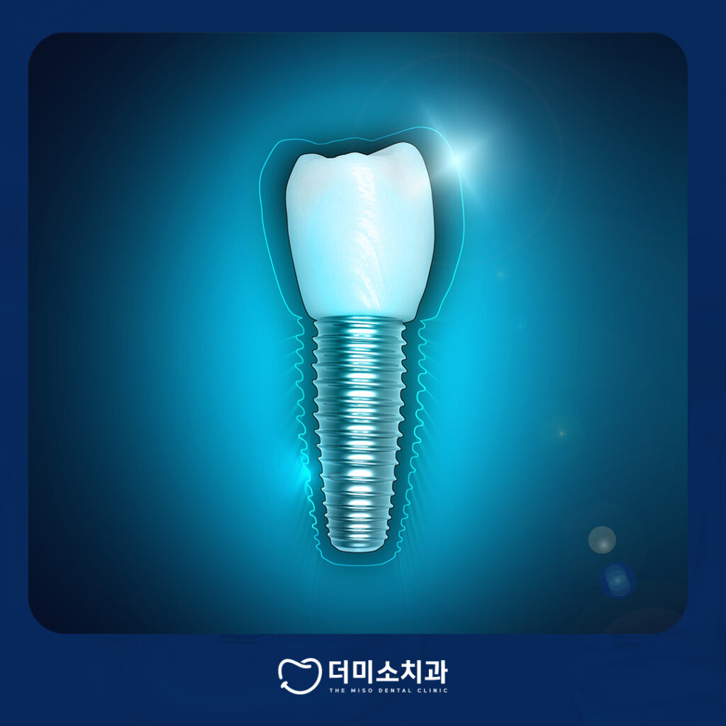 더미소치과 임플란트