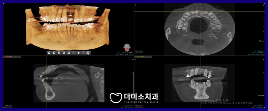 광명동임플란트