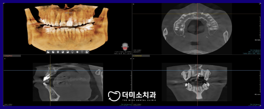 광명동임플란트