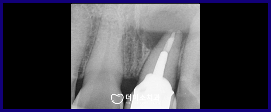 광명동임플란트