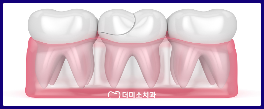 광명동치과