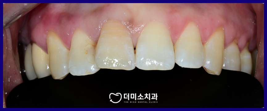 광명동치과