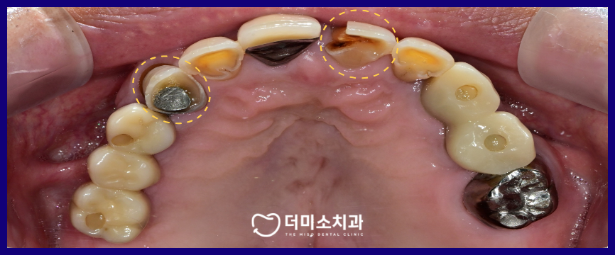 광명동치과
