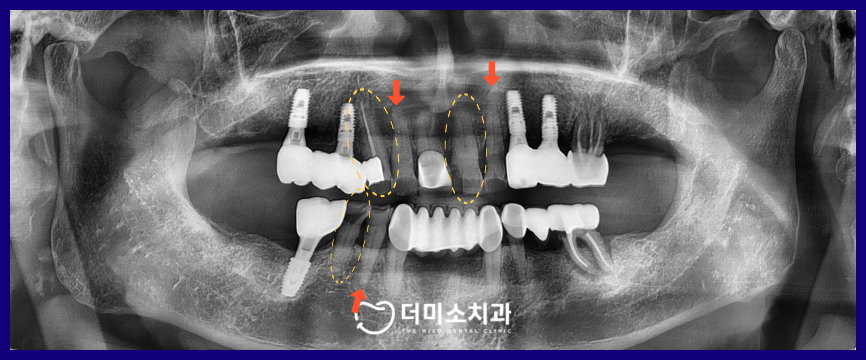 광명동치과