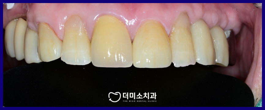 광명동치과